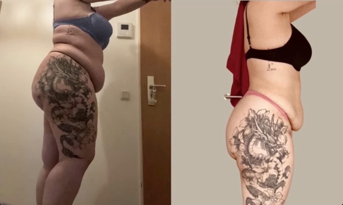 Client before and after