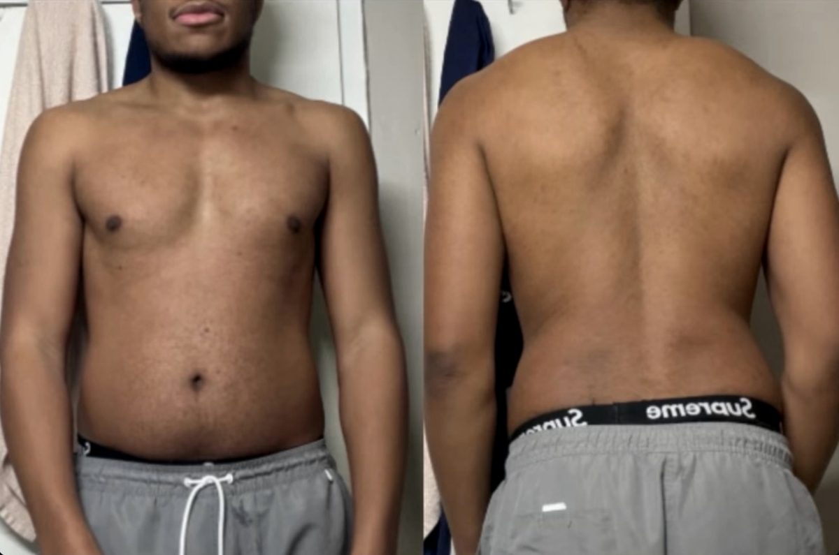 Client before and after