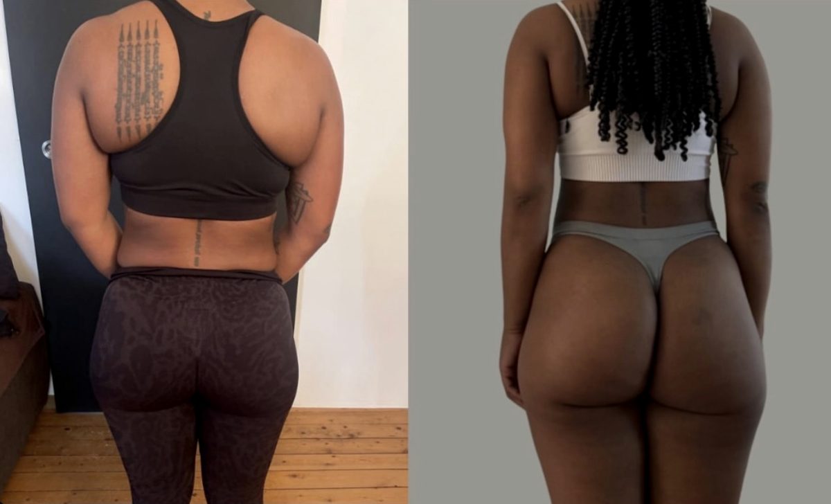 Client before and after