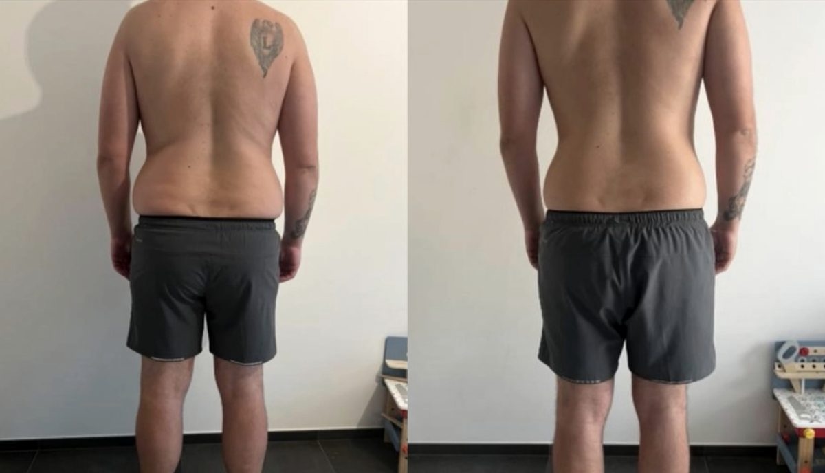 Client before and after