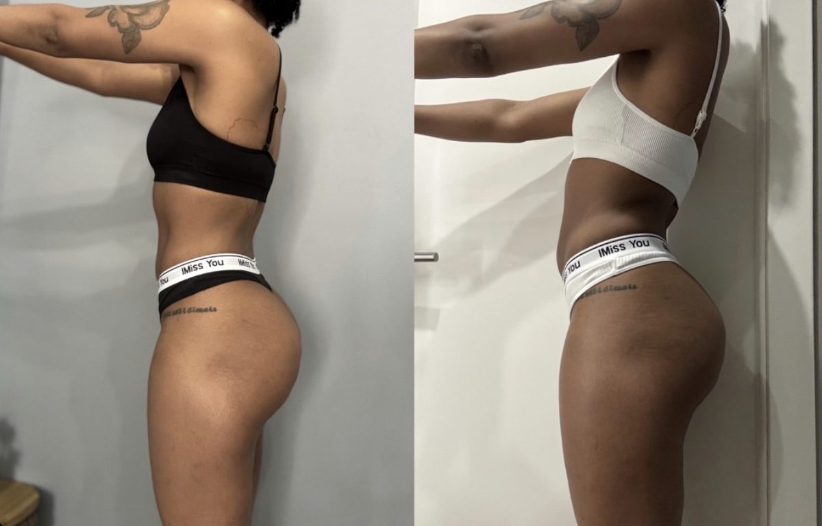 Client before and after