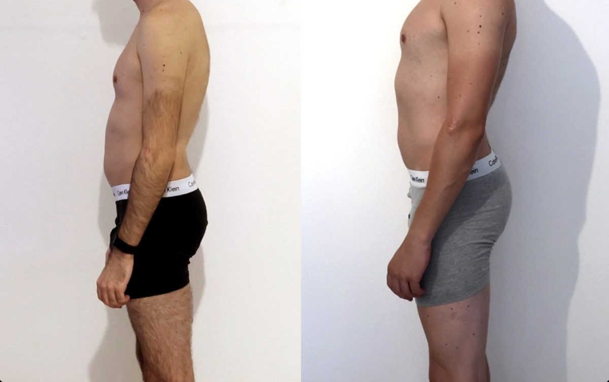 Client before and after